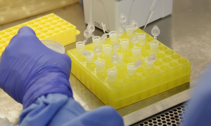 Novo coronavírus: Itália registra 11 mortes e contágios aumentam