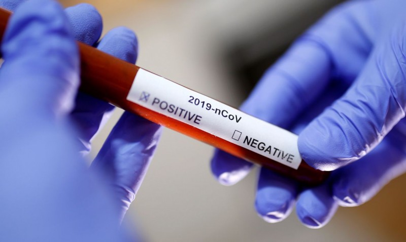 Casos de infecção pelo novo coronavírus continuam a aumentar no mundo