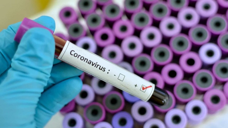 Em 24 horas, casos positivos de coronavírus aumentam 13% em Penápolis