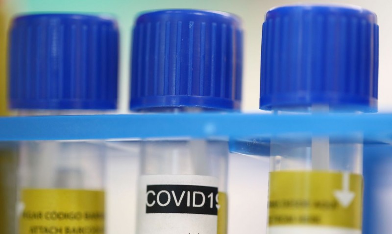 Casos globais de covid-19 superam 11,34 milhões