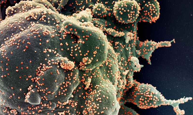 Covid-19: SP tem dois casos identificados da variante Ômicron XQ